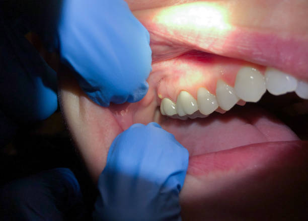 Best Emergency Cosmetic Dentistry in Johnston City, IL