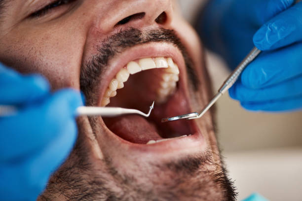 Best Weekend Emergency Dentist in Johnston City, IL