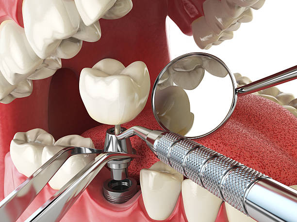 Best Holiday Emergency Dentist in Johnston City, IL